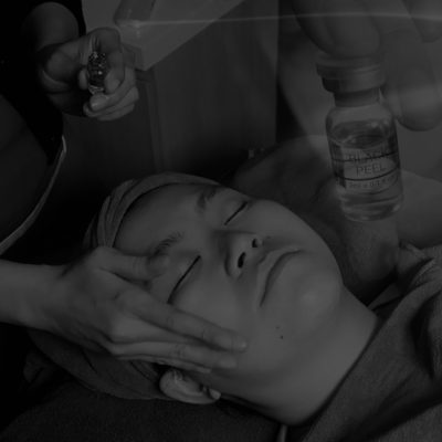 BlackPeel-IGBP-image